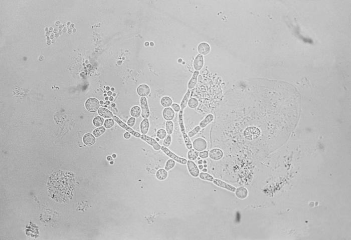 Diese Transmissions-Mikrofotografie zeigt eine Reihe von Candida albicans-Chlamydosporen oder Chlamydoconidien, die in einer Sputumprobe vorhanden waren. C. albicans ist ein hefeartiges Mitglied des Stammes Deuteromycota oder „Fungi Imperfecti“ und der ätiologische Erreger, der für die Krankheit „Candidiasis“ verantwortlich ist. (von CDC/ Brinkman - 1963, Gemeinfrei, https://commons.wikimedia.org/w/index.php?curid=2119141)